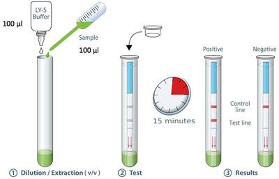Procedimiento del Test SARG-CoV-2 - Infografia